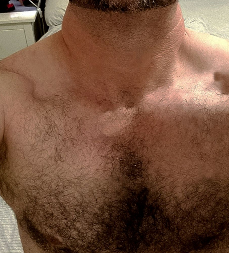 Chest 3